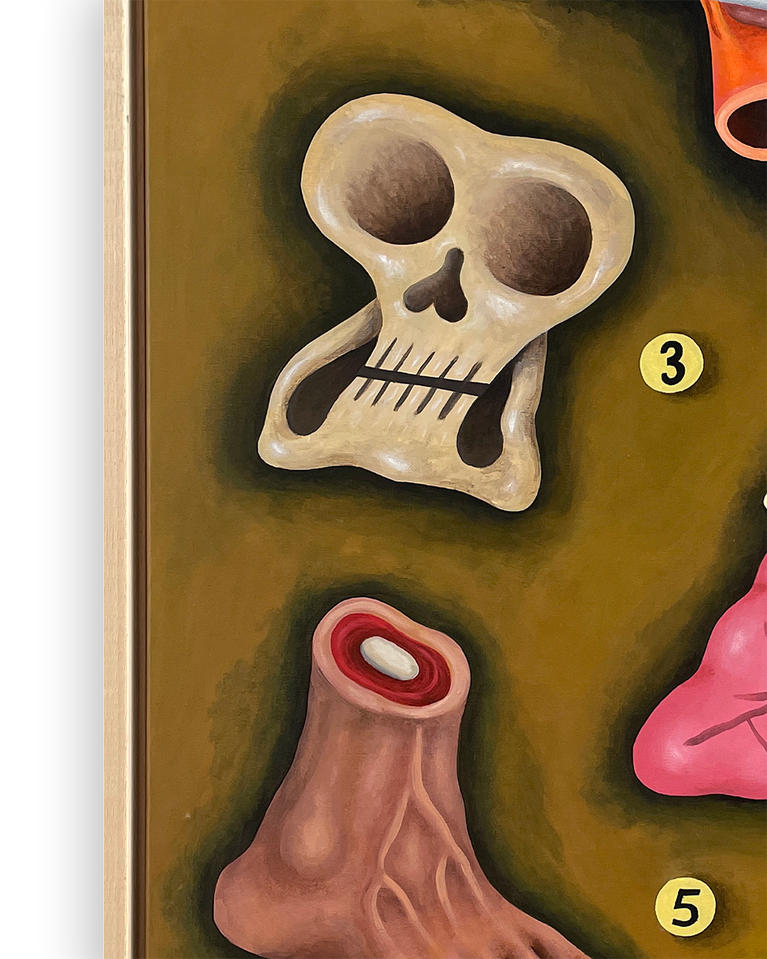 The Anatomy Lesson of Dr. Mooijekind