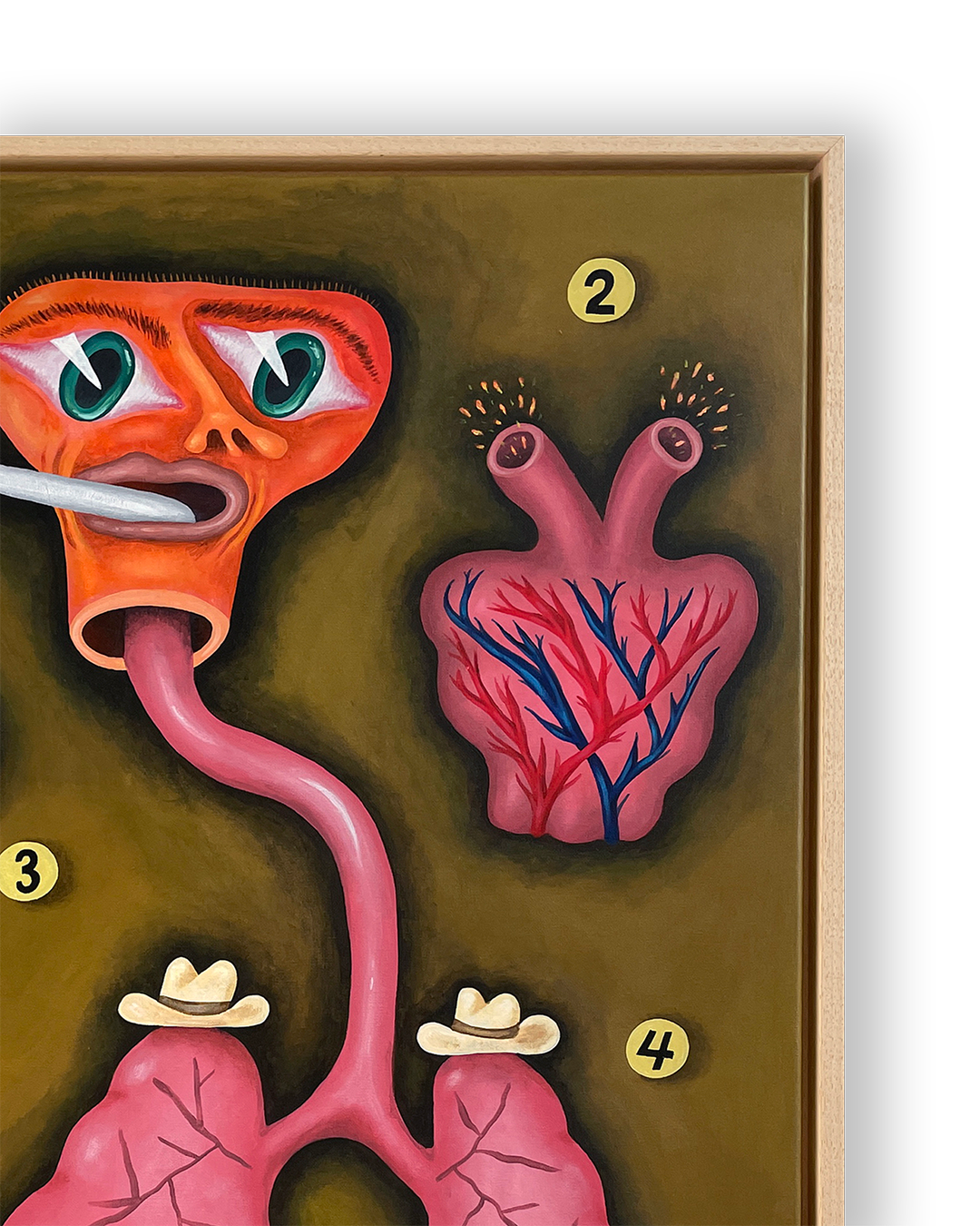 The Anatomy Lesson of Dr. Mooijekind